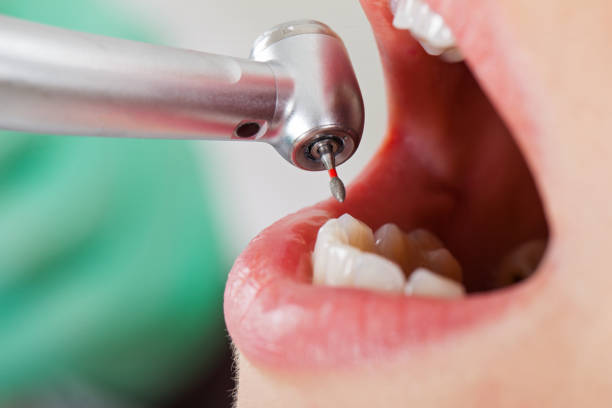 Best Emergency Broken Tooth Repair in Lake Bryan, TX
